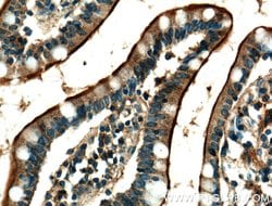 USE1 Rabbit anti-Human, Polyclonal, Proteintech:Antibodies:Primary Antibodies