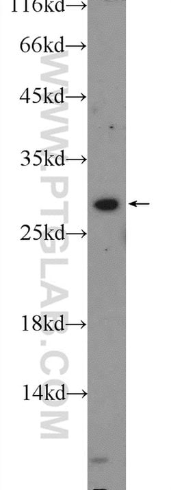 USE1 Rabbit anti-Human, Polyclonal, Proteintech:Antibodies:Primary Antibodies