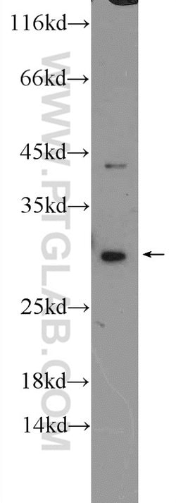 USE1 Rabbit anti-Human, Polyclonal, Proteintech:Antibodies:Primary Antibodies