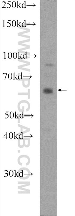 DACH2 Rabbit anti-Human, Mouse, Polyclonal, Proteintech:Antibodies:Primary
