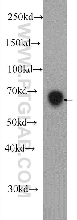 DACH2 Rabbit anti-Human, Mouse, Polyclonal, Proteintech:Antibodies:Primary