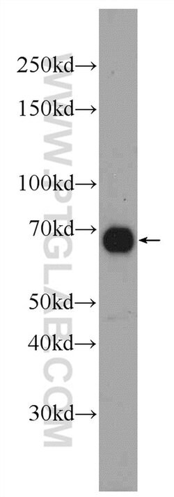 DACH2 Rabbit anti-Human, Mouse, Polyclonal, Proteintech:Antibodies:Primary