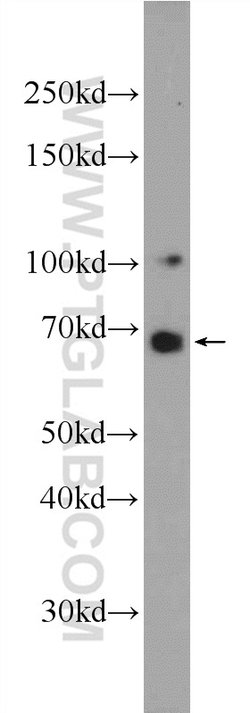 DACH2 Rabbit anti-Human, Mouse, Polyclonal, Proteintech:Antibodies:Primary