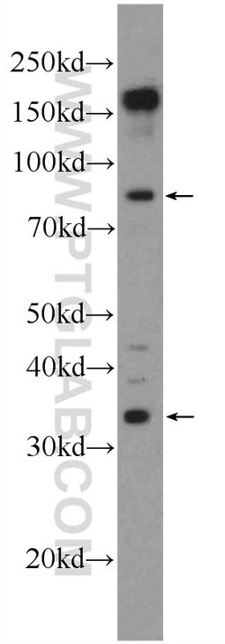 SLMAP Rabbit anti-Human, Mouse, Polyclonal, Proteintech:Antibodies:Primary
