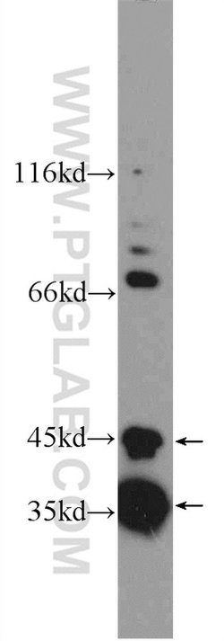 SLMAP Rabbit anti-Human, Mouse, Polyclonal, Proteintech:Antibodies:Primary