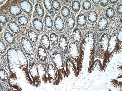 KLHL28 Rabbit anti-Human, Mouse, Polyclonal, Proteintech 150 &mu;L; Unconjugated:Antibodies,