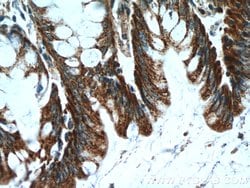 KLHL28 Rabbit anti-Human, Mouse, Polyclonal, Proteintech 150 &mu;L; Unconjugated:Antibodies,