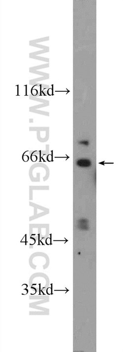 KLHL28 Rabbit anti-Human, Mouse, Polyclonal, Proteintech 150 &mu;L; Unconjugated:Antibodies,