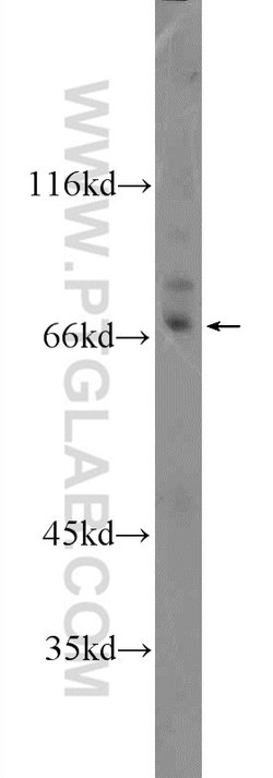 KLHL28 Rabbit anti-Human, Mouse, Polyclonal, Proteintech 150 &mu;L; Unconjugated:Antibodies,