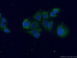 Galectin 10 Rabbit anti-Human, Polyclonal, Proteintech 150 &mu;L; Unconjugated:Antibodies,