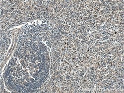 Galectin 10 Rabbit anti-Human, Polyclonal, Proteintech 150 &mu;L; Unconjugated:Antibodies,