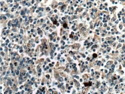 Galectin 10 Rabbit anti-Human, Polyclonal, Proteintech 150 &mu;L; Unconjugated:Antibodies,