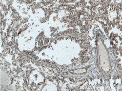 Galectin 10 Rabbit anti-Human, Polyclonal, Proteintech 150 &mu;L; Unconjugated:Antibodies,