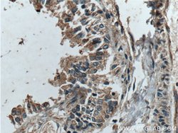 Galectin 10 Rabbit anti-Human, Polyclonal, Proteintech 150 &mu;L; Unconjugated:Antibodies,