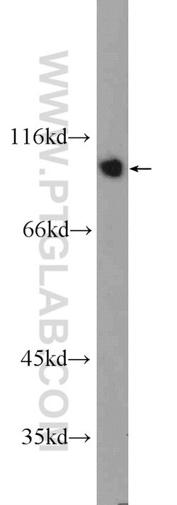 IFT80 Rabbit anti-Human, Mouse, Polyclonal, Proteintech:Antibodies:Primary