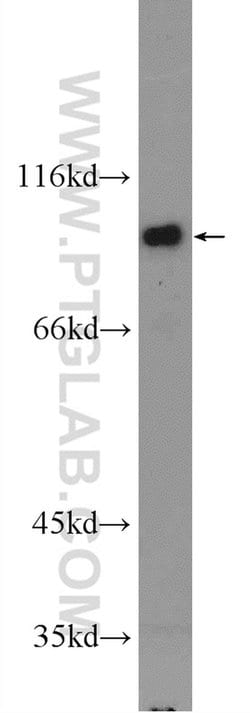 IFT80 Rabbit anti-Human, Mouse, Polyclonal, Proteintech:Antibodies:Primary