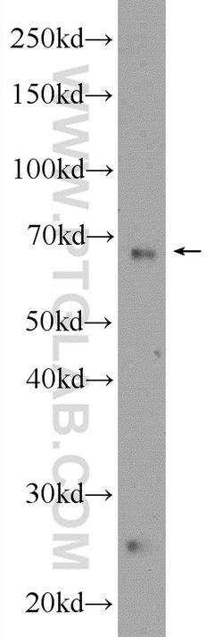 NCOA6 Rabbit anti-Human, Mouse, Polyclonal, Proteintech:Antibodies:Primary