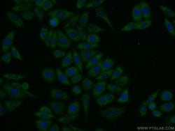 TBC1D24 Rabbit anti-Human, Polyclonal, Proteintech 150 &mu;L; Unconjugated:Antibodies,