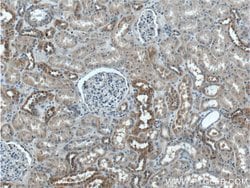 TBC1D24 Rabbit anti-Human, Polyclonal, Proteintech 150 &mu;L; Unconjugated:Antibodies,