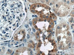 TBC1D24 Rabbit anti-Human, Polyclonal, Proteintech 150 &mu;L; Unconjugated:Antibodies,