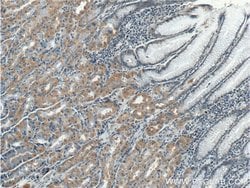 TBC1D24 Rabbit anti-Human, Polyclonal, Proteintech 150 &mu;L; Unconjugated:Antibodies,