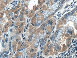 TBC1D24 Rabbit anti-Human, Polyclonal, Proteintech 150 &mu;L; Unconjugated:Antibodies,