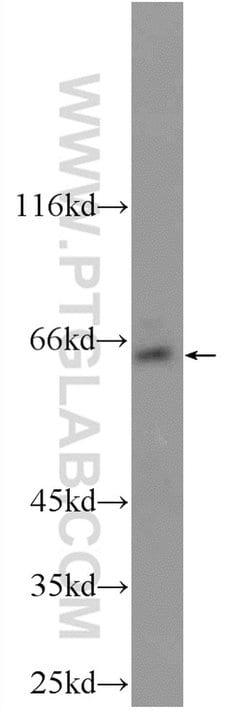 TBC1D24 Rabbit anti-Human, Polyclonal, Proteintech 150 &mu;L; Unconjugated:Antibodies,