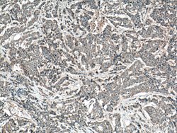 FAM20A Rabbit anti-Human, Mouse, Polyclonal, Proteintech 150 &mu;L; Unconjugated:Antibodies,