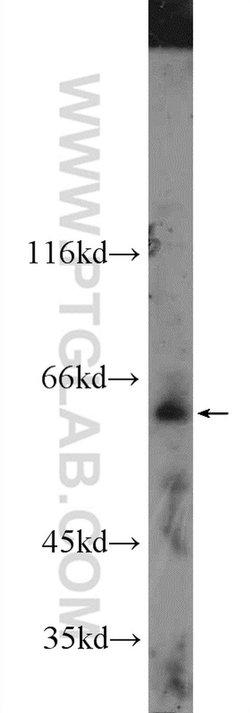FAM20A Rabbit anti-Human, Mouse, Polyclonal, Proteintech 150 &mu;L; Unconjugated:Antibodies,