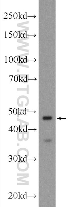 CRHR2 Rabbit anti-Human, Mouse, Rat, Polyclonal, Proteintech 150 &mu;L;