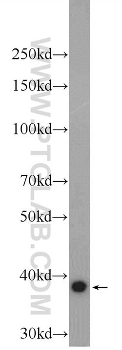 FAM98C Rabbit anti-Human, Polyclonal, Proteintech 20 &mu;L; Unconjugated:Antibodies,
