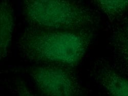 PHOX2B Rabbit anti-Human, Mouse, Polyclonal, Proteintech:Antibodies:Primary