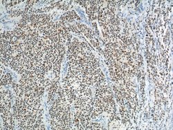 PHOX2B Rabbit anti-Human, Mouse, Polyclonal, Proteintech:Antibodies:Primary