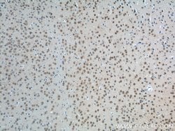 PHOX2B Rabbit anti-Human, Mouse, Polyclonal, Proteintech:Antibodies:Primary