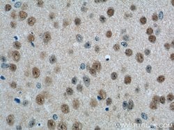 PHOX2B Rabbit anti-Human, Mouse, Polyclonal, Proteintech:Antibodies:Primary