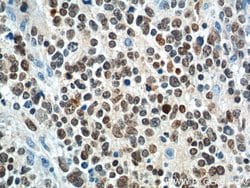 PHOX2B Rabbit anti-Human, Mouse, Polyclonal, Proteintech:Antibodies:Primary