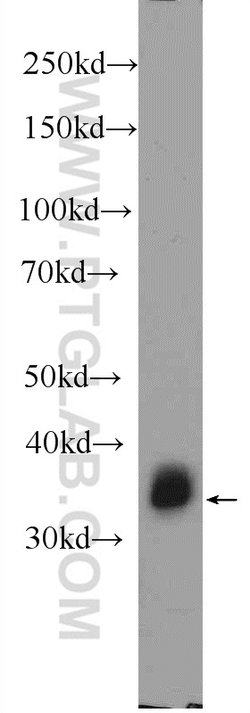 PHOX2B Rabbit anti-Human, Mouse, Polyclonal, Proteintech:Antibodies:Primary