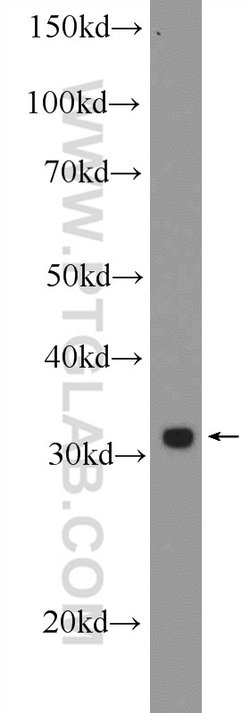 PHOX2B Rabbit anti-Human, Mouse, Polyclonal, Proteintech:Antibodies:Primary