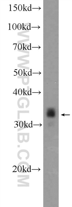 PHOX2B Rabbit anti-Human, Mouse, Polyclonal, Proteintech:Antibodies:Primary