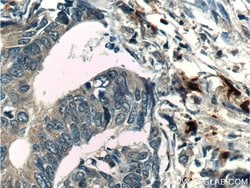 PRTN3 Rabbit anti-Human, Polyclonal, Proteintech