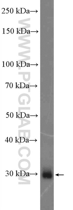 PRTN3 Rabbit anti-Human, Polyclonal, Proteintech:Anticorps:Anticorps primaires