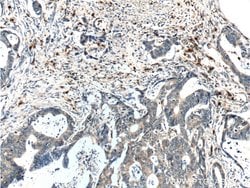 PRTN3 Rabbit anti-Human, Polyclonal, Proteintech:Anticorps:Anticorps primaires