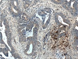 PRTN3 Rabbit anti-Human, Polyclonal, Proteintech:Anticorps:Anticorps primaires