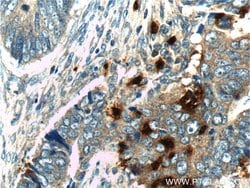 PRTN3 Rabbit anti-Human, Polyclonal, Proteintech:Anticorps:Anticorps primaires