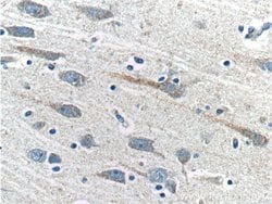PRTN3 Rabbit anti-Human, Polyclonal, Proteintech:Anticorps:Anticorps primaires
