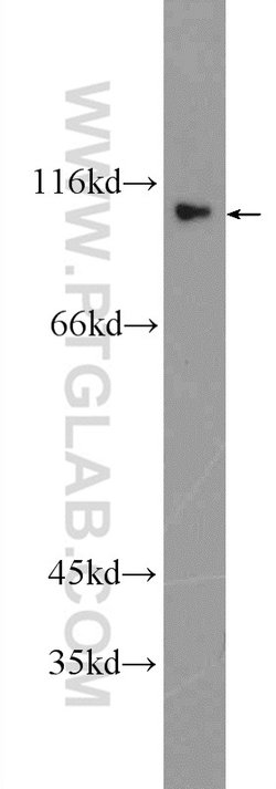 ACDP1 Rabbit anti-Human, Mouse, Rat, Polyclonal, Proteintech:Antibodies:Primary