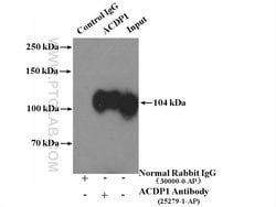 ACDP1 Rabbit anti-Human, Mouse, Rat, Polyclonal, Proteintech:Antibodies:Primary
