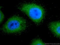 TRAPPC2L Rabbit anti-Human, Mouse, Polyclonal, Proteintech:Antibodies:Primary