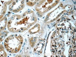 TRAPPC2L Rabbit anti-Human, Mouse, Polyclonal, Proteintech:Antibodies:Primary