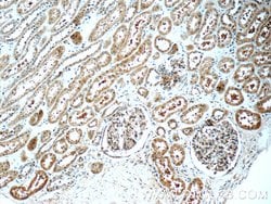 TRAPPC2L Rabbit anti-Human, Mouse, Polyclonal, Proteintech:Antibodies:Primary